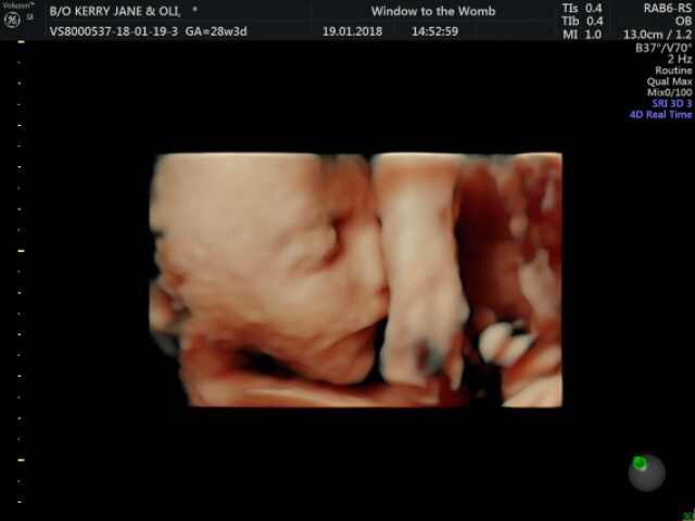 Oli Regan 4D Scan Window to the Womb
